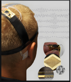Micro brain-computer interfaces are available